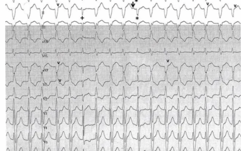 每日一题_2022.3.17