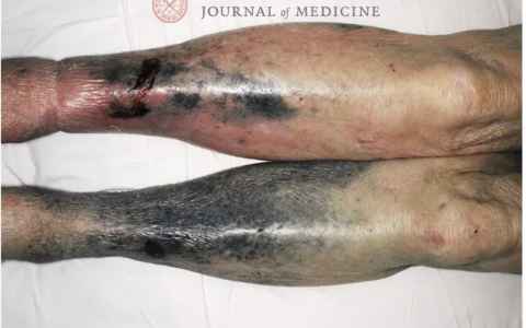 每日一题_2022.3.22