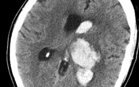 每日一题_2022.3.27