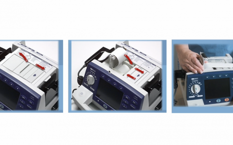 电除颤的评分要点