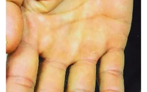 每日一题_2022.3.21