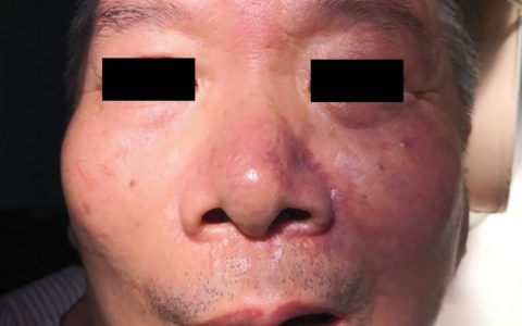 每日一题_2022.3.24