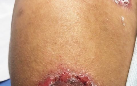 每日一题_2022.3.16