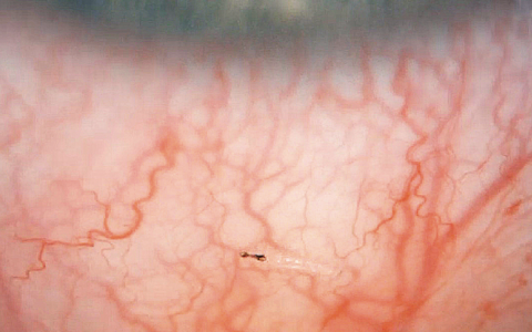 每日一题_2022.4.1