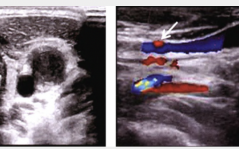 每日一题_2022.4.2