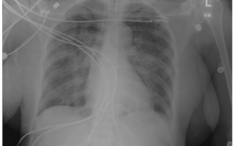 每日一题_2022.4.3