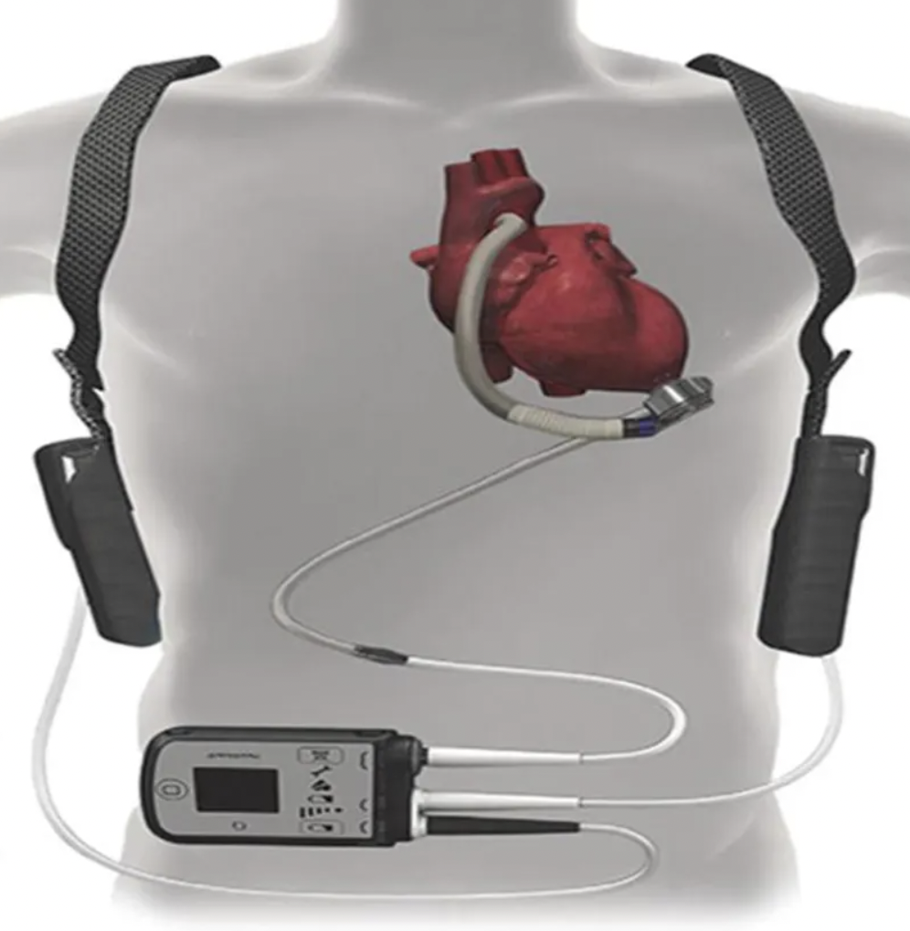 每日一题_2022.4.7