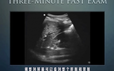 每日一题_2022.4.9