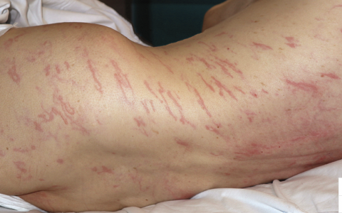 每日一题_2022.4.15