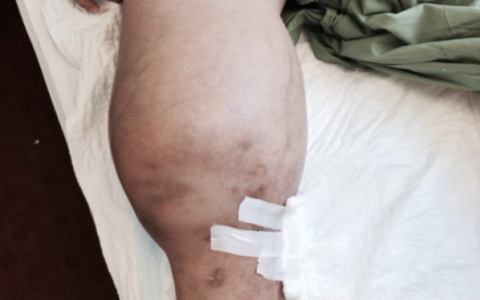 每日一题_2022.4.18