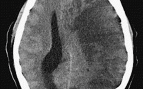 每日一题_2022.4.19