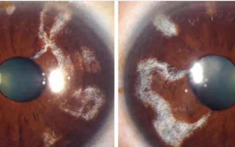 每日一题_2022.4.23