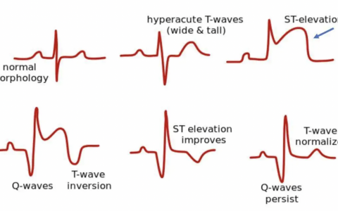 每日一题_2022.4.25