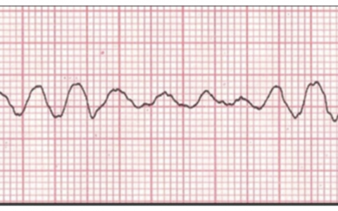 每日一题_2022.5.4