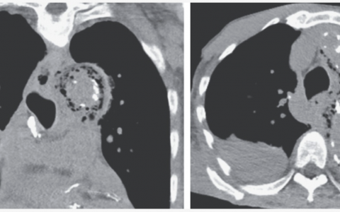 每日一题_2022.5.6