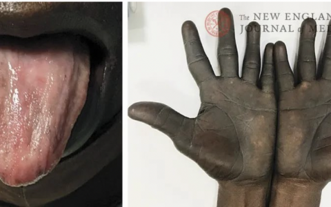 每日一题_2022.5.7