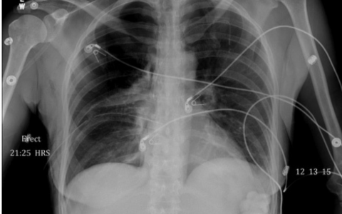 每日一题_2022.5.9