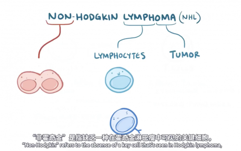 【Osmosis】非霍奇金淋巴瘤 Non-Hodgkin Lymphoma