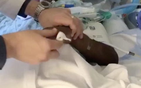 Neurology病例：脑死亡中的反射动作：临床查体的挑战