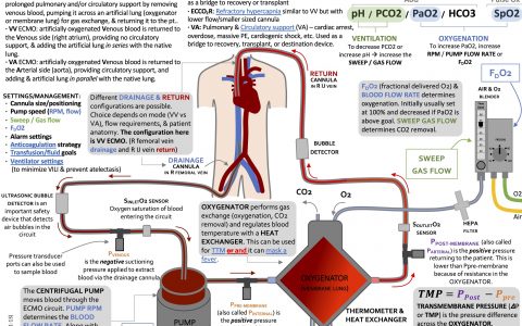 ICU OnePager：ECMO基本原理