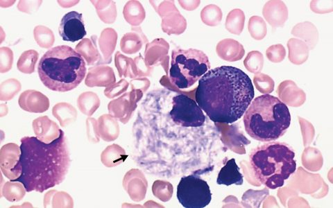 每日一题_2022.5.14