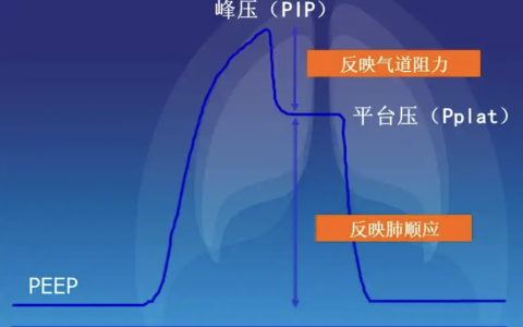 每日一题_2022.06.04