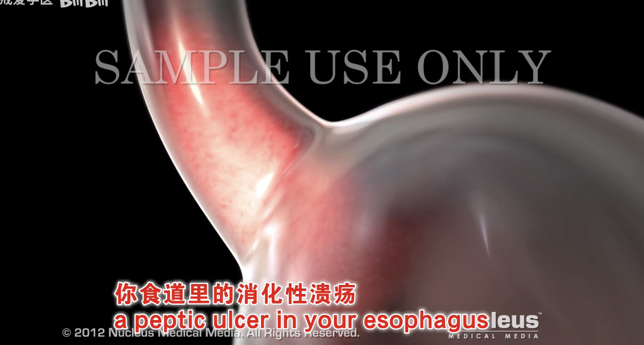 每日一题_2022.06.06