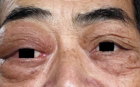 每日一题_2022.06.09