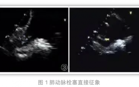 每日一题_2022.06.12