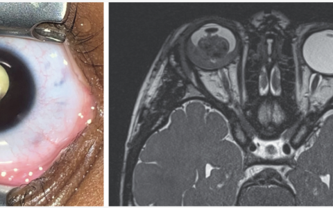 每日一题_2022.06.16