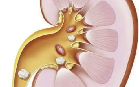 每日一题_2022.06.21