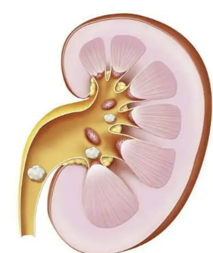 每日一题_2022.06.21