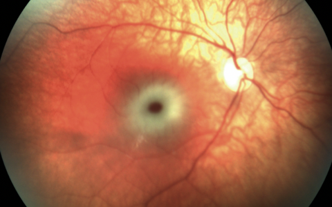 每日一题_2022.06.24