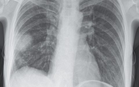 每日一题_2022.06.30