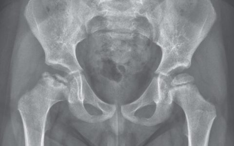 每日一题_2022.6.2