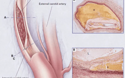 每日一题_2022.07.01