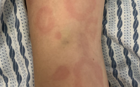 每日一题_2022.07.02