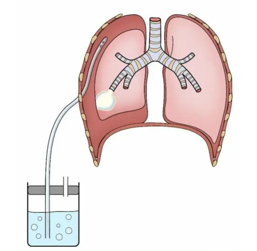 每日一题_2022.07.07