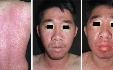 每日一题_2022.07.08