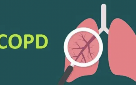 每日一题_2022.07.11