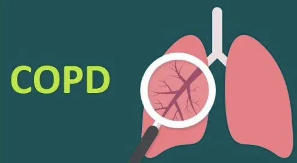 每日一题_2022.07.11