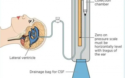 每日一题_2022.07.13