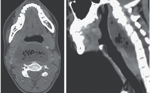 每日一题_2022.07.14