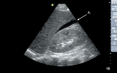 每日一题_2022.07.16