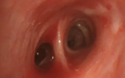 每日一题_2022.07.18