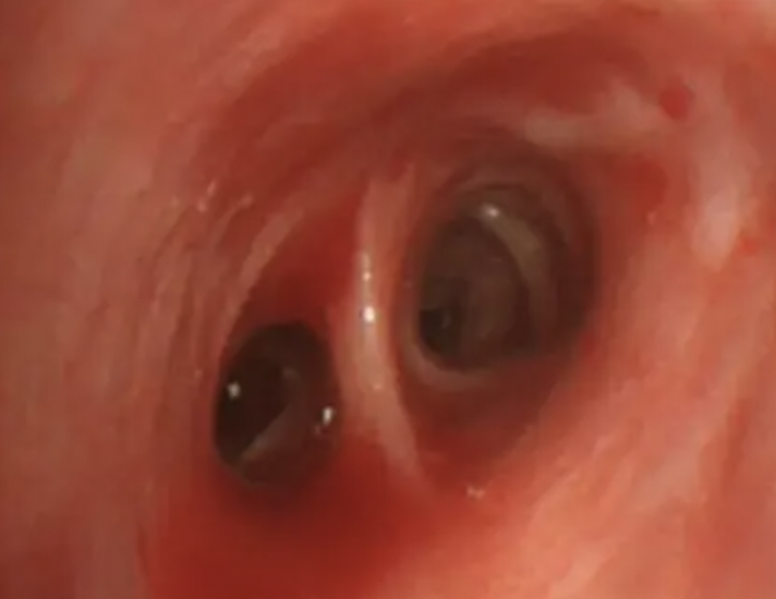 每日一题_2022.07.18