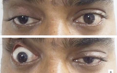 每日一题_2022.07.22