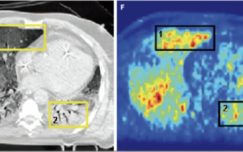 每日一题_2022.07.23