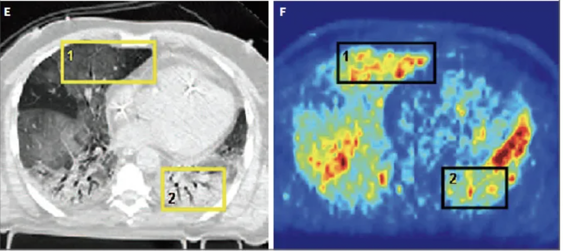 每日一题_2022.07.23