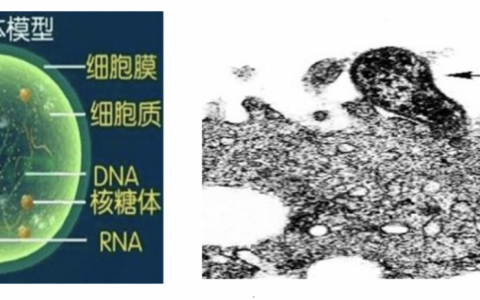 支原体肺炎诊治
